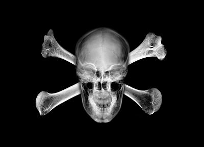 skulls, X-Ray, skull and crossbones - random desktop wallpaper